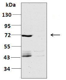 CERK1 | Chitin elicitor receptor kinase 1 in the group Antibodies Plant/Algal / Hormones / Biosynthesis/regulation at Agrisera AB (Antibodies for research) (AS16 4037)